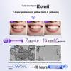 Sakol Smart Whitening Toothpaste, Orchid Fragrance