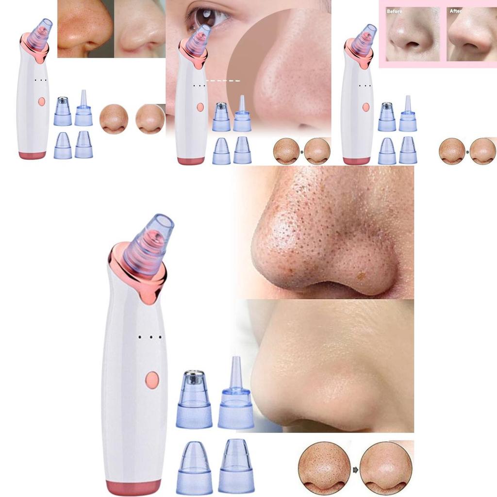 2020 Model Electric Blackhead Vacuum Cleaner For Deep Pore Cleansing And Care