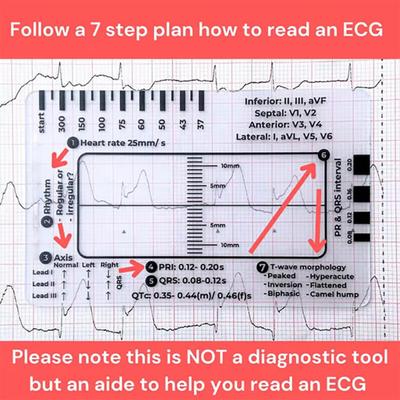 Transparentes 7-Stufen-Lineal Messwerkzeug Kompaktes Design Tragbares EKG-Interpretations-Taschenhandbuch Beurteilung