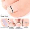 2 Pcs Ingrown Toenail Correction Tool Ingrown Toenail Treatments Elastic Patch Sticker Toenail Straightening Pedicure Tools