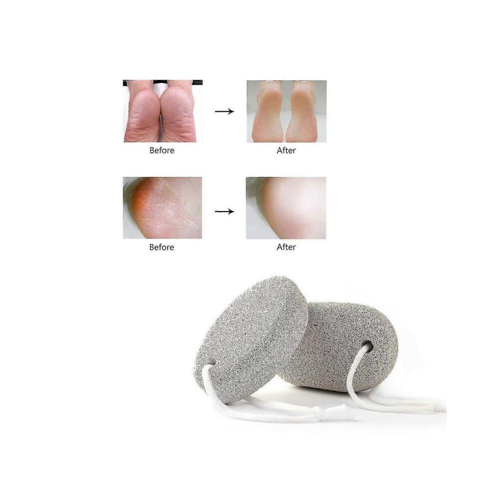 Natural Pumice Stone for Feet - Callus Remover And Foot Exfoliation Tool