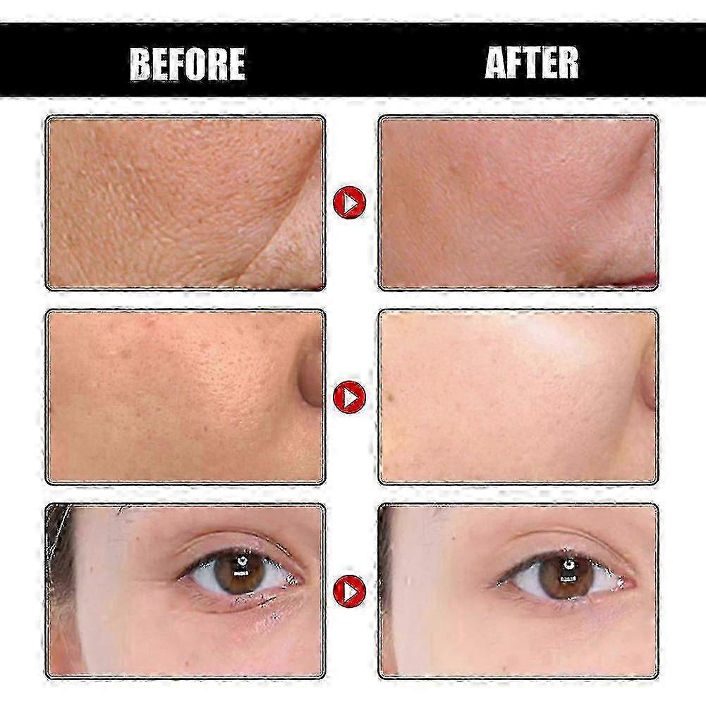 3x Wrinkle Remover Serum Lifting Firming Fade Fine Lines Anti-aging Brighten Skin Tone Lighten Facial Wrinkles D