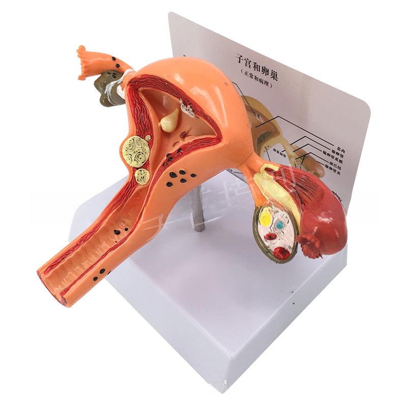 

Большая модель женской репродуктивной анатомии для обучения и планирования семьи