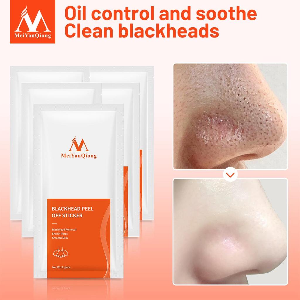 Cleansing Anti-Blackhead Nasal Strips 3/6/10/20/40pcs