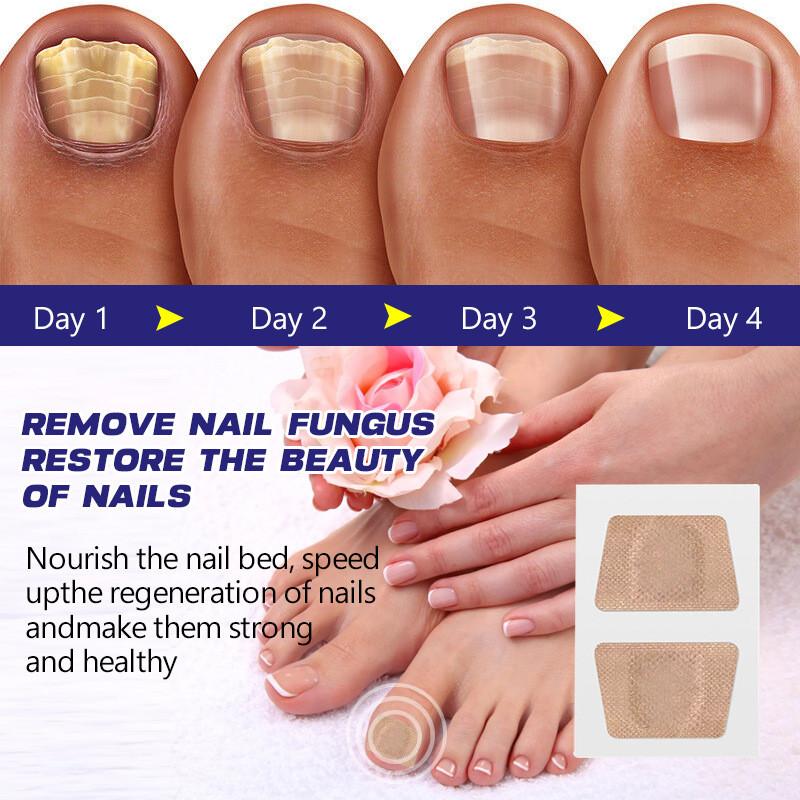 Hbesty Toenail Repair Patches For Damaged Soft Nails With Herbal Scented Comfort 40 Count