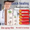 Nuobiyan Wound Healing Spray