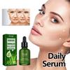 Hoygi Anti-aging Serum For Wrinkle Reduction Firming Skin Tightening 30ml