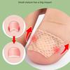 10/20 Pairs Nail Care Patch Inlay Nail Groove Into the Meat Toe Pad Screen Protector Long Soft Nail Gray Nail Orthopedic Sticker