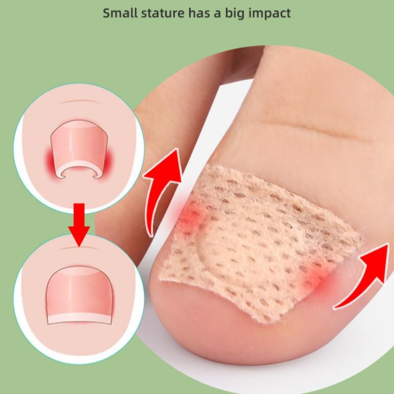 10/20 Pairs Nail Care Patch Inlay Nail Groove Into the Meat Toe Pad Screen Protector Long Soft Nail Gray Nail Orthopedic Sticker