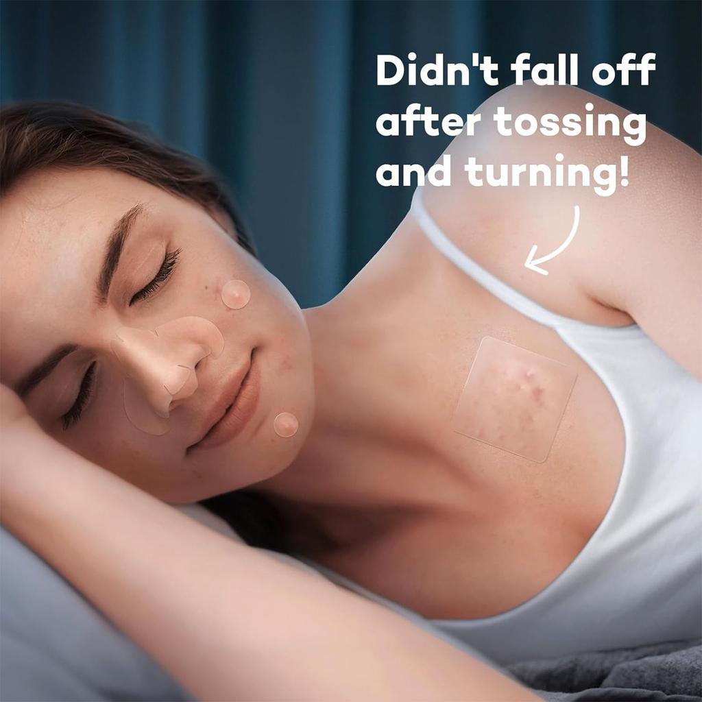 Akne-Patch Großpackung Pickel-Patches, Niedliche Pickelabdeckungen, Hydrokolloid-Akne-Patches mit Hyaluronsäure 262 Stück