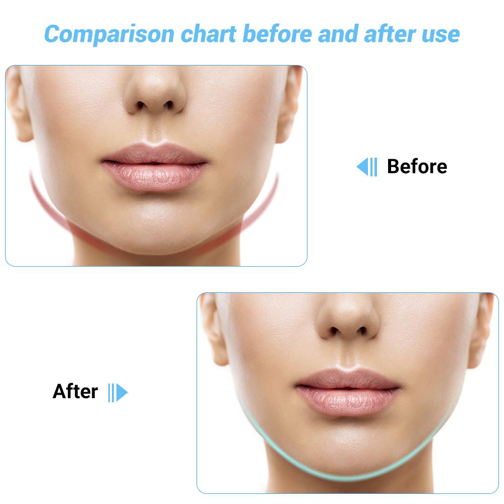 EMS Facial Massager Chin Lift Belt LED Photon Therapy Face Slimming Vibration Device Cellulite Jaw Face Lifting Machine Dropship