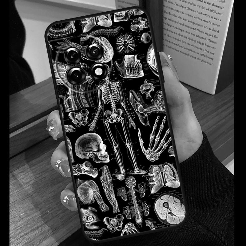 Medical Skeleton Anatomy Case For OnePlus 15 R 13T 13R 12R 10T 8T 13 12 11 9 10 Pro Nord 5 CE 4 2 3 Lite N20 N30 Cover