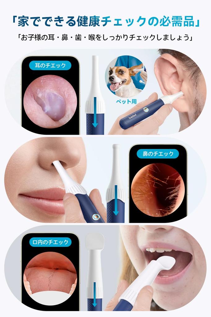 BEBIRD R37R Earpick with Ear Cleaning with 10 Million and Storage IP67 4 Cleaning Recording and Photo Suitable for Elderly and Compatible with