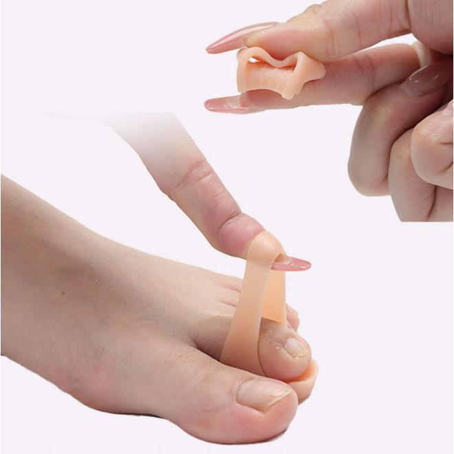 Zehentrenner-Korrektor SEBS Zehenpolster-Glätteisen Fußpflege-Tool Neu