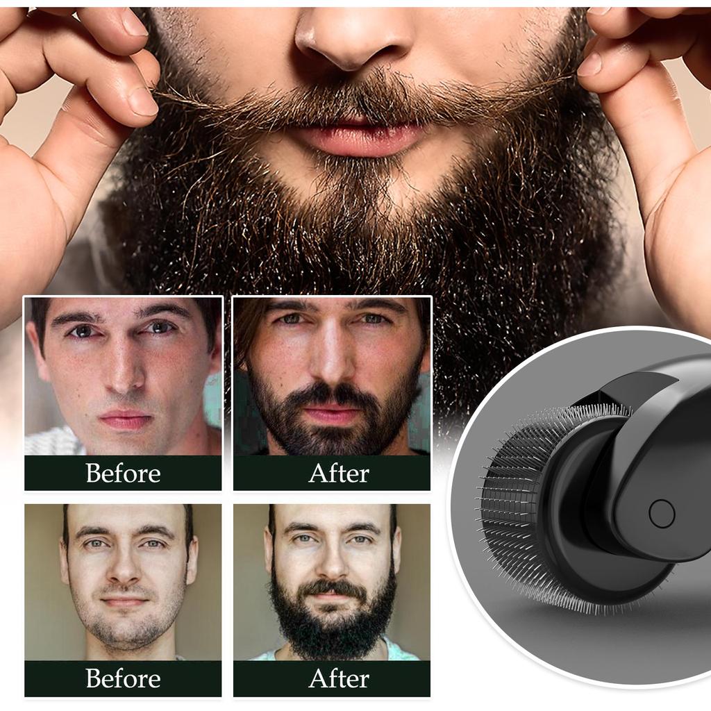 Men's Beard Oil Set – Deeply Nourishes, Smooths, Moisturizes, and Adds Shine To Beard Hair While Removing Odor, Showcasing Masculine Charm.