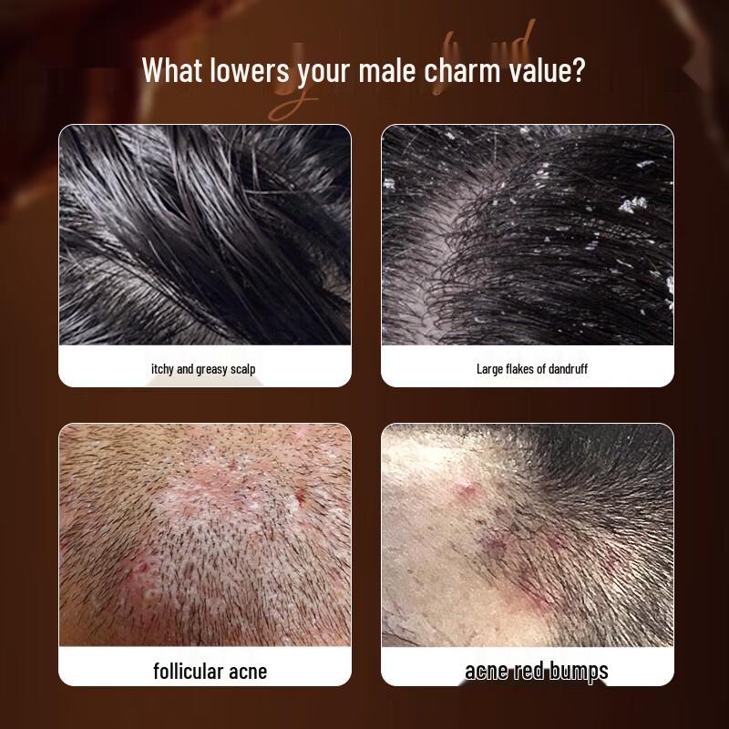 OSXE Men's Oil Control Anti-Dandruff Hair & Body Care