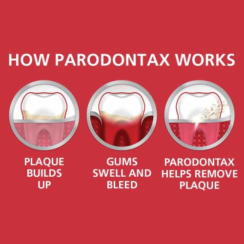 Parodontax Whitening Toothpaste for Bleeding Gums, Teeth Whitening and Gingivitis Treatment - 3.4 Ounces
