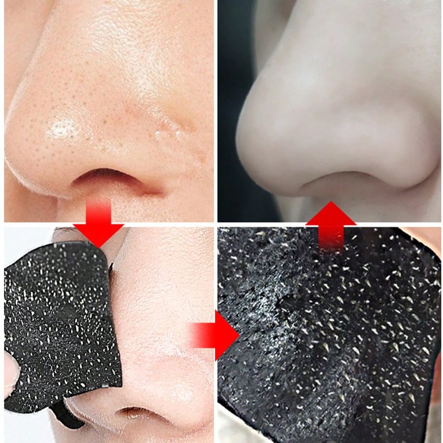1/5/10/20PCS Bamboo Charcoal Blackhead Suction Nasal Mask Pack, Caring Nose Patch, Blackhead Removal