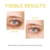 OOTD - Dark Circle Eye Serum