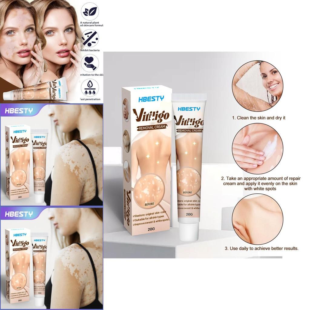 Body Gentle Whitening Cream For Skin Spot Care Formulated For All Skin Types