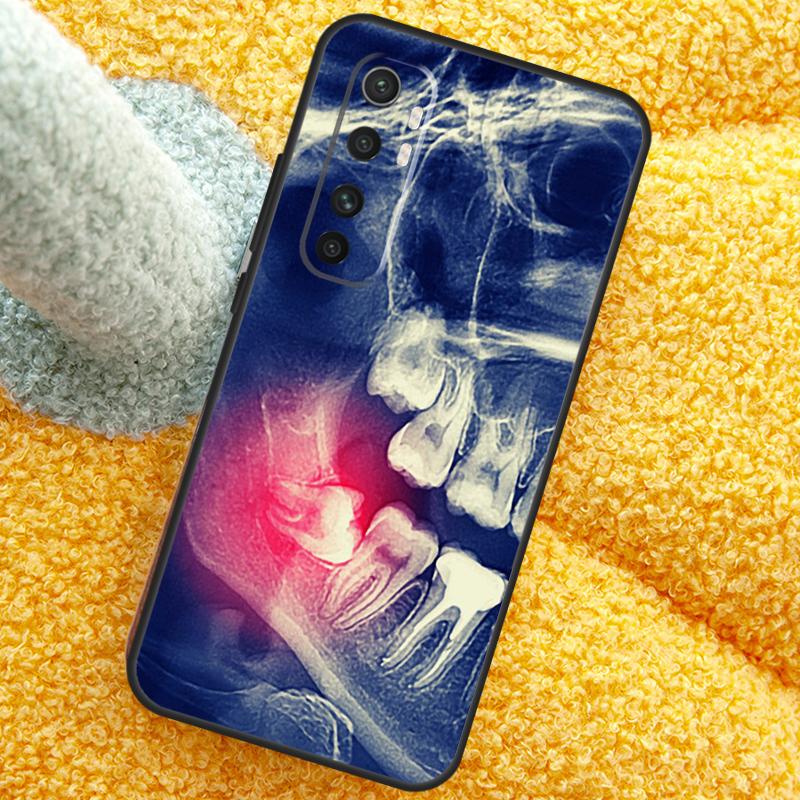 Zahnarzt Zahnmuster Hülle Für Xiaomi 13T 14T 15T 14 15 Ultra 17 Pro Max Abdeckung Für POCO F8 F7 X7 Pro F5 F6 X5 X6