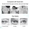 Crema para Ojos con Niacinamida Elimina Ojeras Bolsas debajo de los Ojos Suero Hidratante con Ácido Hialurónico Contra la Hinchazón Gel para el Cuidado de los Ojos