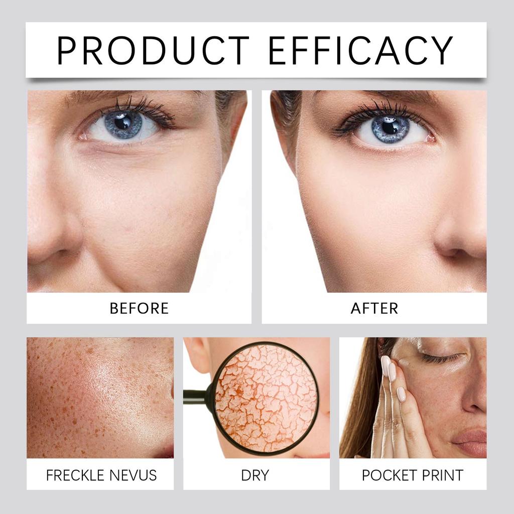 EELHOE Firming & Hydrating Filler Pills Hydrating & Nourishing Firming Skin Moisturizing & Soothing Skin Facial Cream