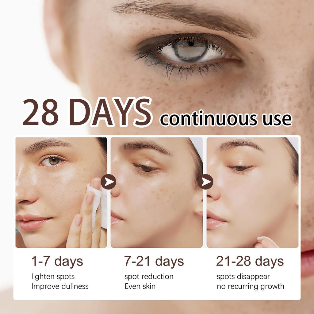 Spots Peel Off Facial Mask Freckle Pigmentation Removal Cream Chloasma Care Dark Spot Correction Glow Whiten Peeling Mask Strong
