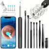 Smart Otoscope Camera Ear Cleaning Wax Wifi Hd Application Endoscope