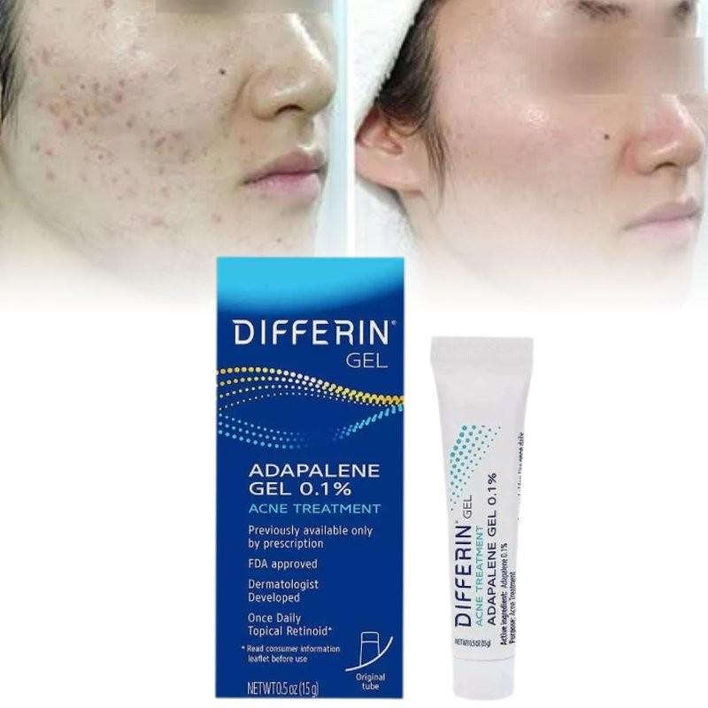Differin Gel Traitement Acné Gel Rétinoïde Pour Peau Claire Radieuse 15g