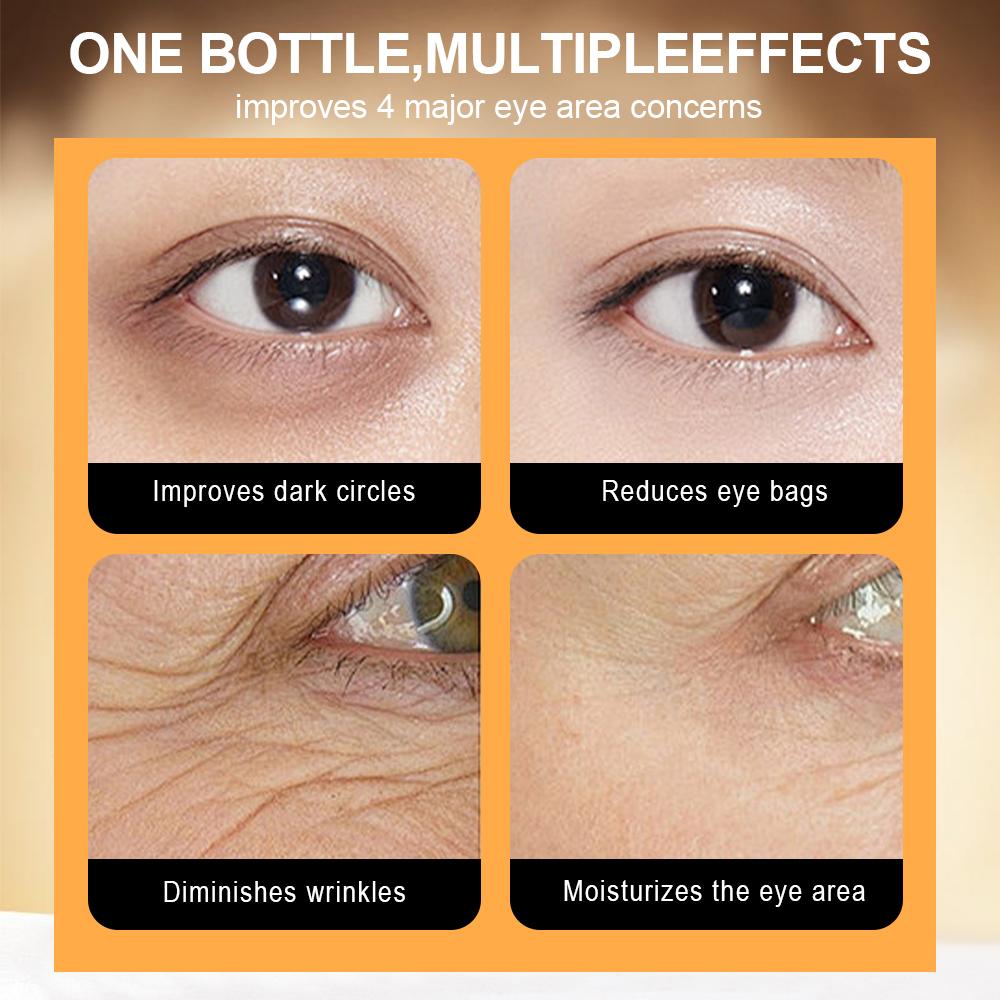 1pcs Polypeptide Caviar Anti-wrinkle Massage Eye Cream To Lift, Tighten and Fade Fine Lines and Dark Circles Eye Care