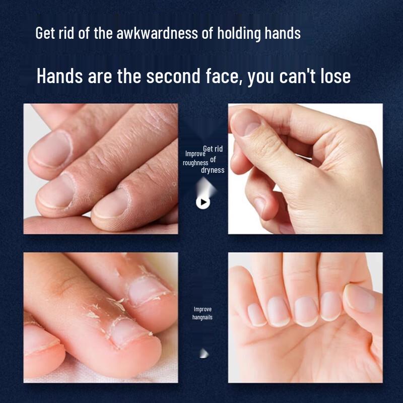 HIEUAILR German Hand Cream for Dry, Chapped Hands