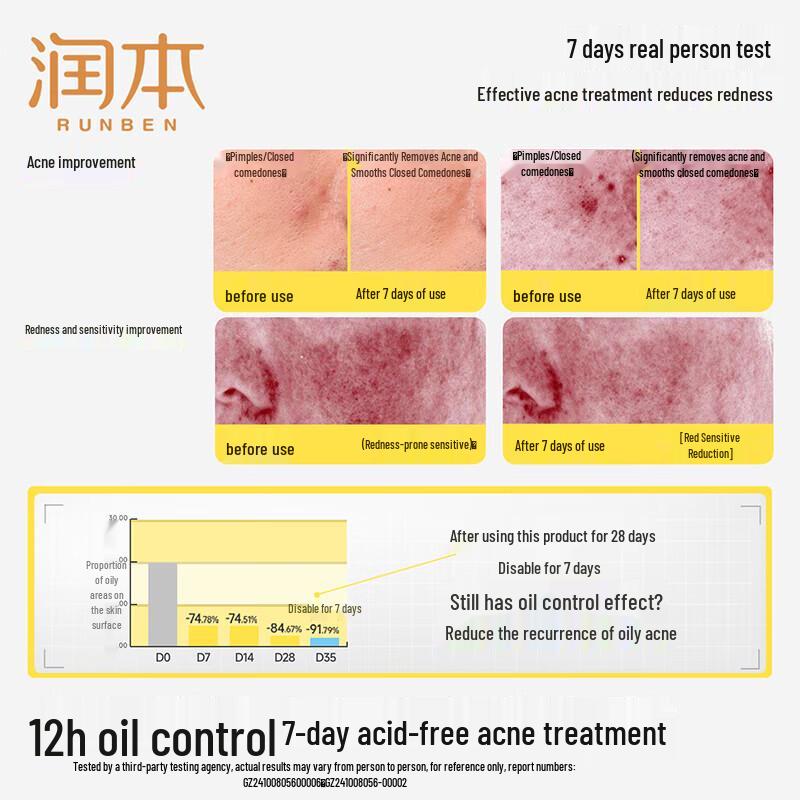 RUNBEN Teen Oil Control Acne Toner 150ml