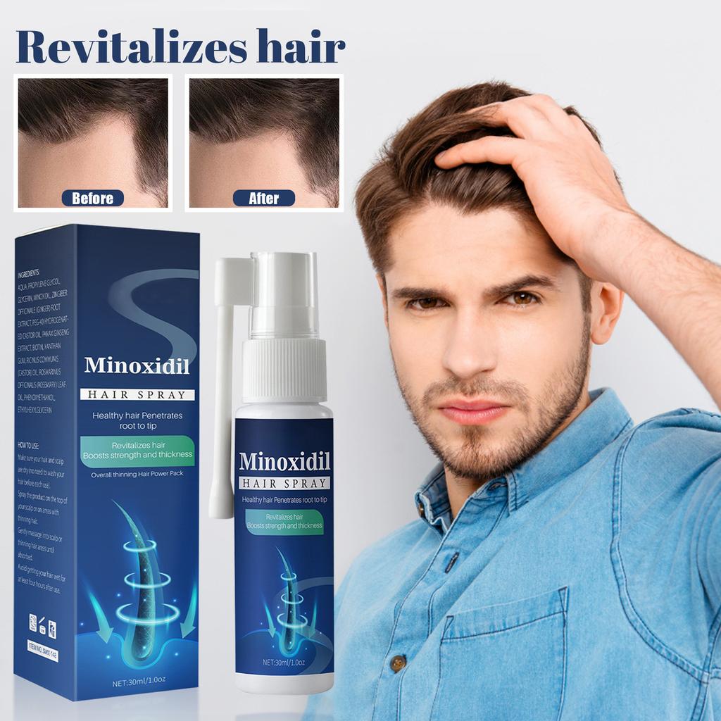 Solution de minoxidil à usage externe, 30 ml/spray, stoppe la chute des cheveux chez l'homme, accélère naturellement la pousse des cheveux et réactive les follicules rétrécis.