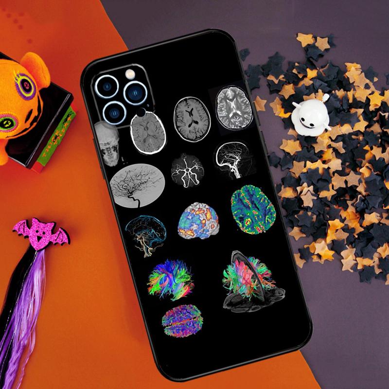 

Anatomy Brain Bumper Case For iPhone 15 16 14 Pro Max 11 12 13 Pro Max Mini XR 16e 16 15 Plus Phone Cover iPhone 14 Pro