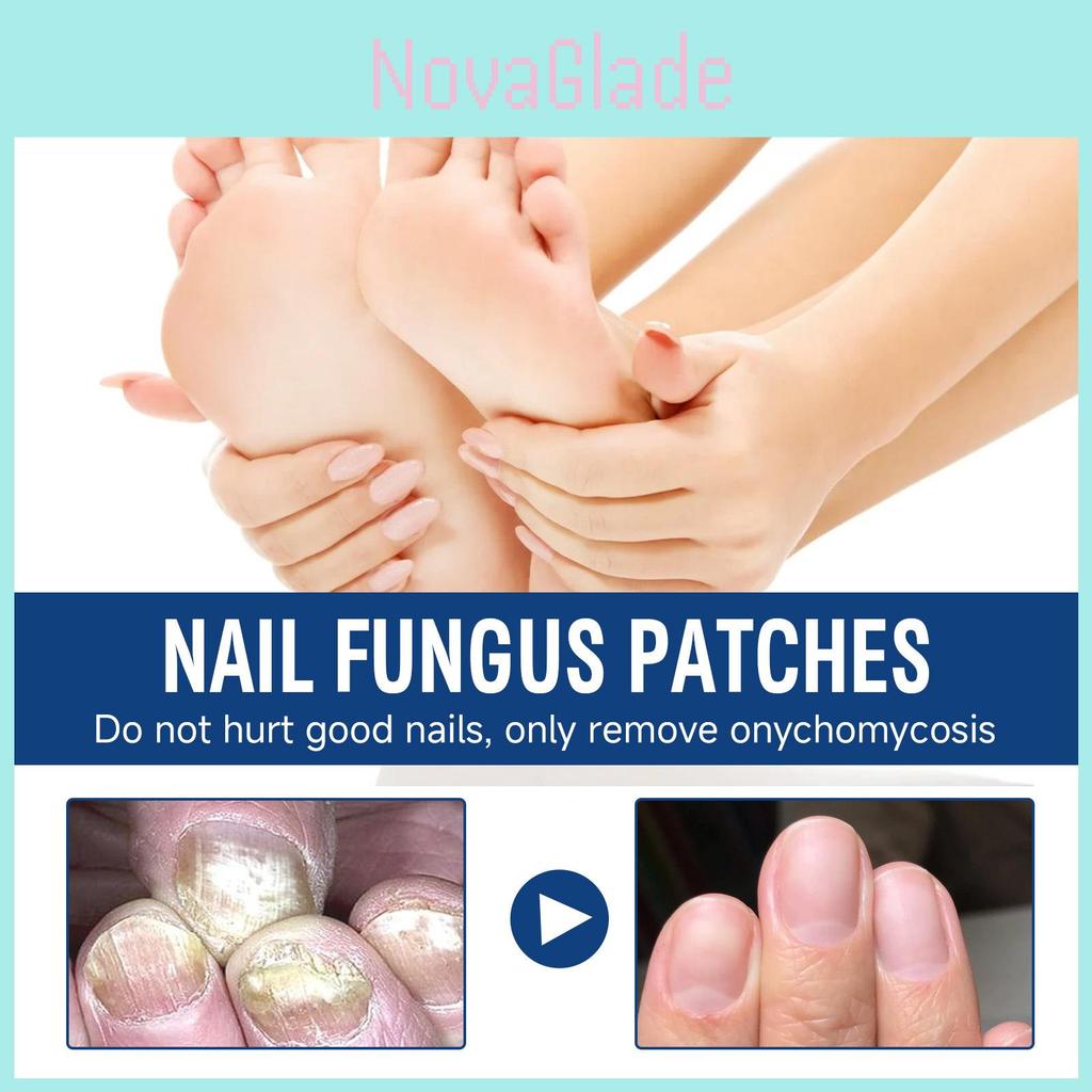 Ximonth Nährende Formel für gesunde, starke, weiche Nägel und Nagelhautpflege