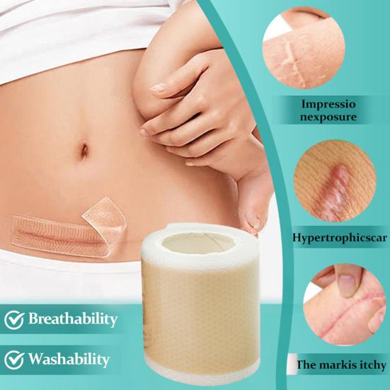 Silicone Scar Sheet Reusable Self-adhesive Breathable Waterproof Scar Removal Strip C-section Burns Acne Surgical Scar Treatment Tape