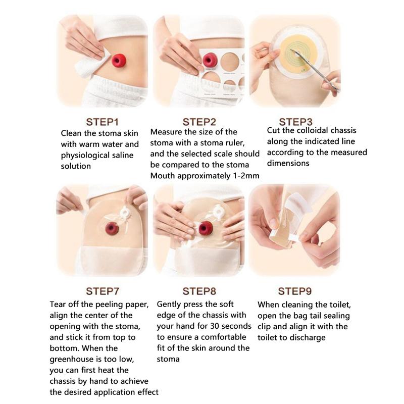 1Pcs Exhaustable Colostomy Bags 65Mm Hole One-Piece Drainable Ostomy Bags Stoma Care Pouch With Clips Closure Colostomy Bag