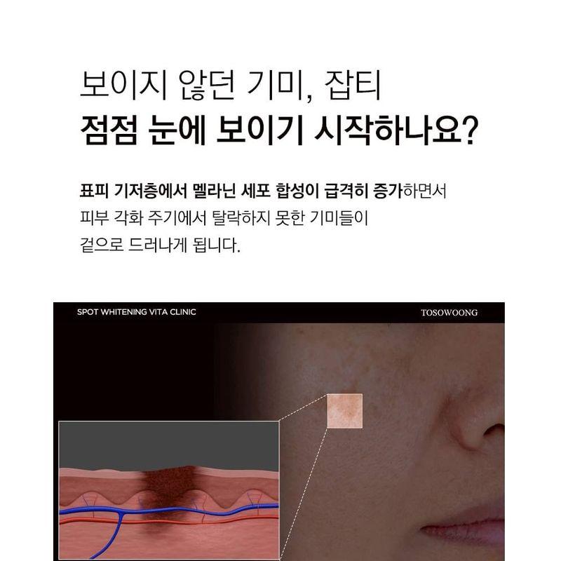 TOSOWOONG - Spot Whitening Vita Clinic
