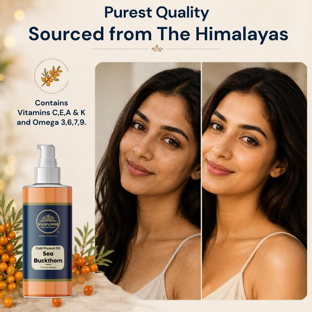 Wildflower Essentials Sanddornöl Kaltgepresst Reich an Omega 3,6,7,9 für Gesicht Haut Haare & Körper Feuchtigkeit Rein & Natürlich (50ml)