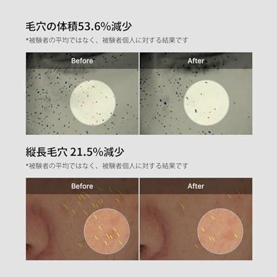 Medikube Zero Pore One Day Cream 50ml exfoliation care Korean cosmetics roughness sensitive skin dry skincare line
