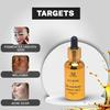 HOUSE OF BEAUTY Pigmentation Oil for Glowing Face, Damaged, Darkened, Pigmented and Uneven Skin (30ml, Pack of 1)