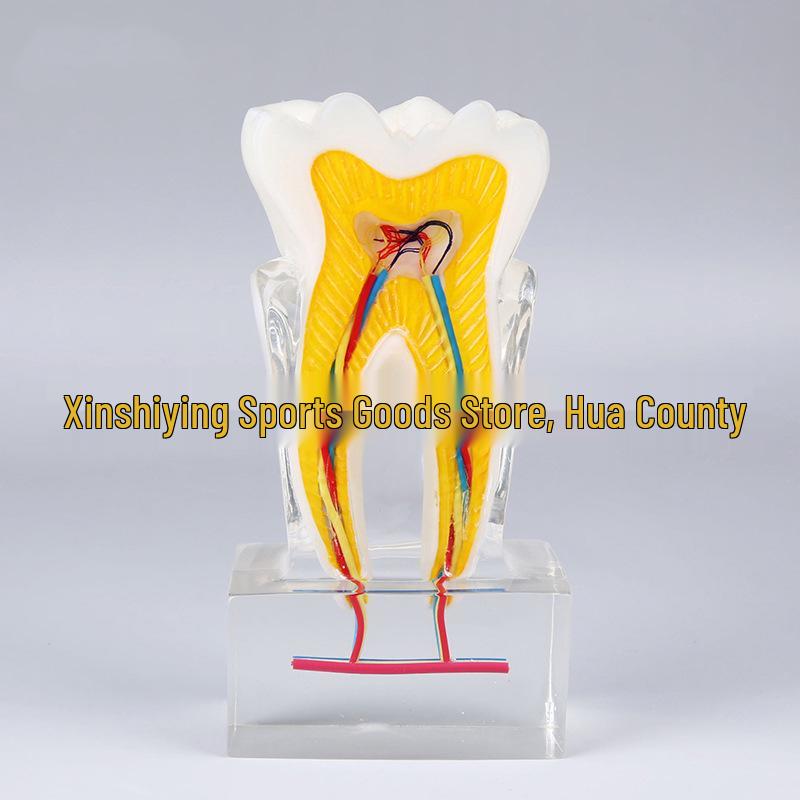 Oral Teaching Model: Magnified Dental U6 Tooth and Nerve Structure Crystal Display 6x Nerve