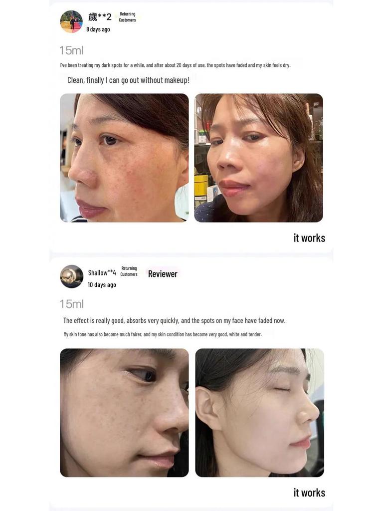 Han Bei Dan White Oil - Whitening & Freckle Removal Essence