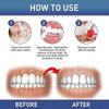 New Gum Therapy Gel 4ml, Safe and Effective Teeth Whitening Gel, Teeth Whitening Essence Pen, Gum Remover for Sensitive Teeth