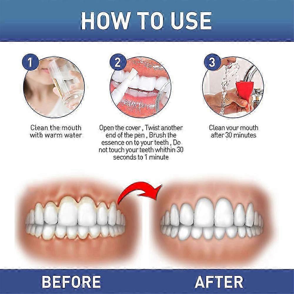 New Gum Therapy Gel 4ml, Safe and Effective Teeth Whitening Gel, Teeth Whitening Essence Pen, Gum Remover for Sensitive Teeth