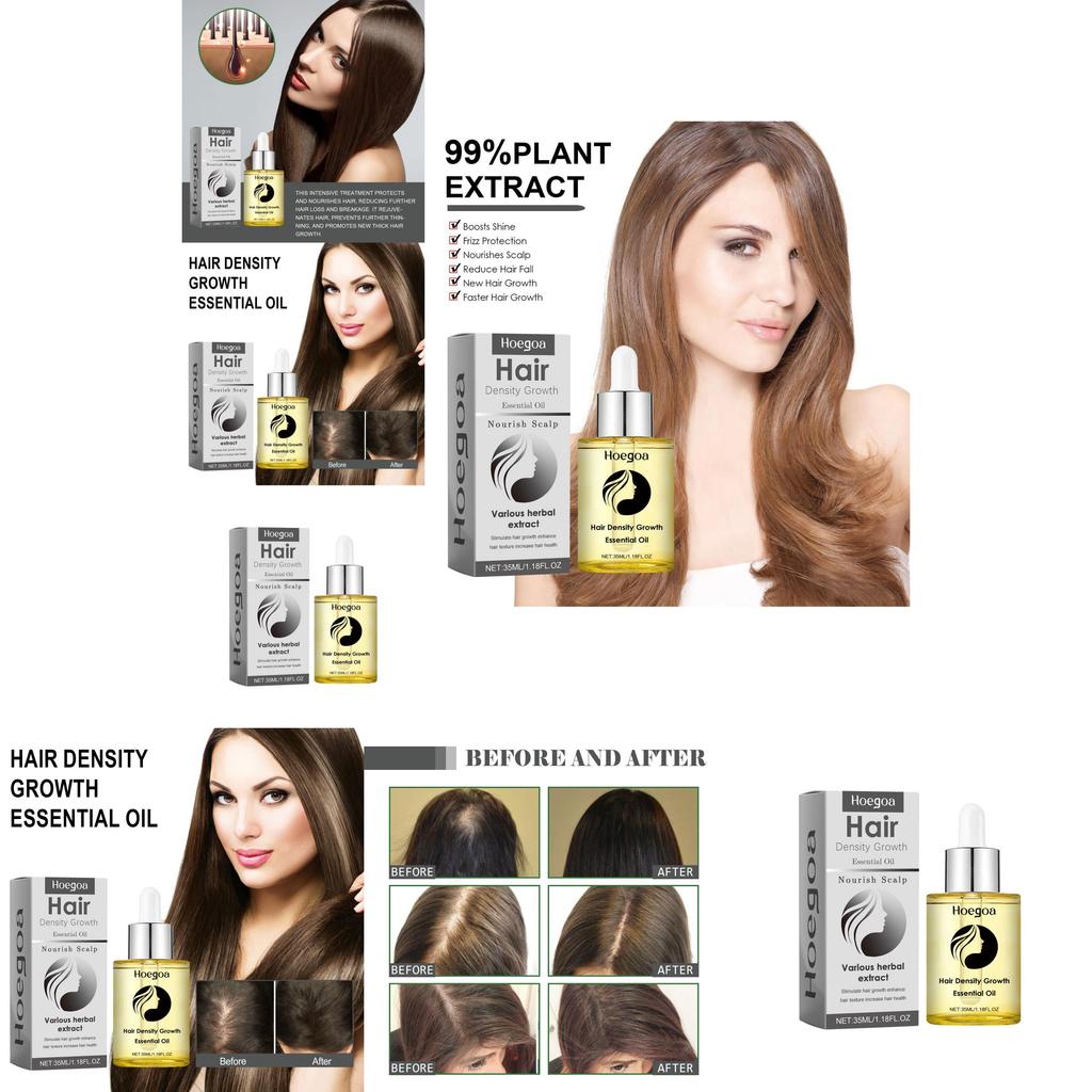 Hoegoa Nourishing Hair Oil For Damaged And Dry Hair Promoting Healthy Softness 35ml