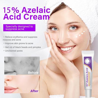 12% Azelaic Facial Serum Skin Hyaluronic And Soothing And Brightening The Skin Tone 20G
