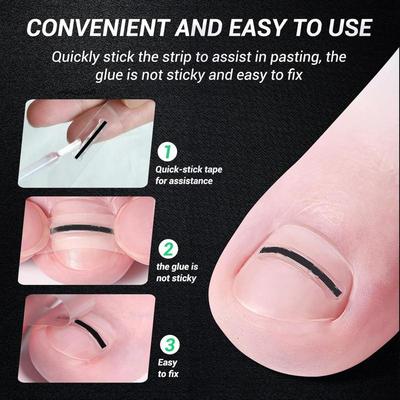 Juego de 5 Piezas de Herramientas de Corrección para Uñas Encarnadas del Pie Parche Elástico Adhesivo Pinza Enderezadora para Uñas del Pie Kit de Tratamiento de Pedicura