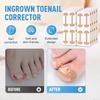 Professionelles Set für eingewachsene Zehennägel mit atmungsaktiven Streifen für eingewachsene Zehennägel, Korrekturpflaster für gekrümmte Zehennägel, schmerzfreier Feile und Heber Pediküre-Werkzeuge